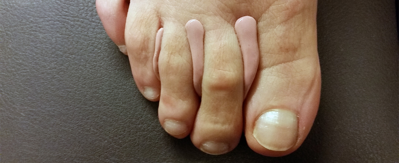 Helpt een siliconen-orthese bij voetklachten?  Helpt een siliconen-orthese bij voetklachten?