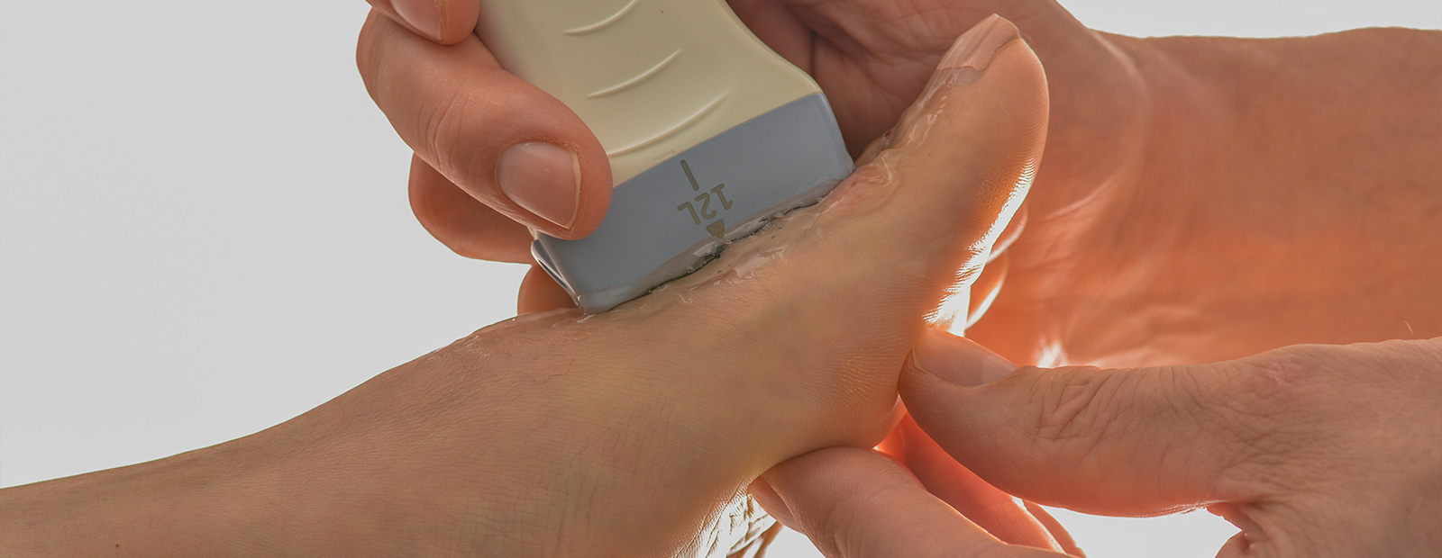 Echografisch onderzoek bij pijnlijke voeten Echografisch onderzoek bij pijnlijke voeten